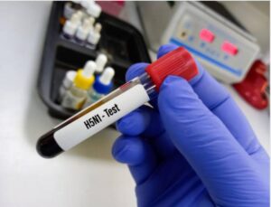 WHO ने Bird flu स्ट्रेन H5N2 से पहली मौत की पुष्टि की