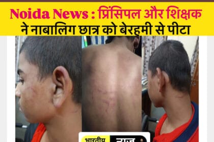 नोएडा के कैलाश पब्लिक स्कूल में मानवता को शर्मसार करने वाली घटना: प्रिंसिपल और शिक्षक ने नाबालिग छात्र को बेरहमी से पीटा
