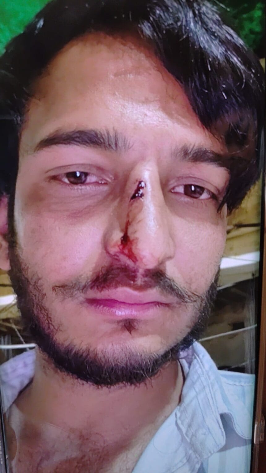 दनकौर के रामपुर माजरा में शादी समारोह में मामा-भांजे पर हमला, चार आरोपियों ने डंडों से पीटा