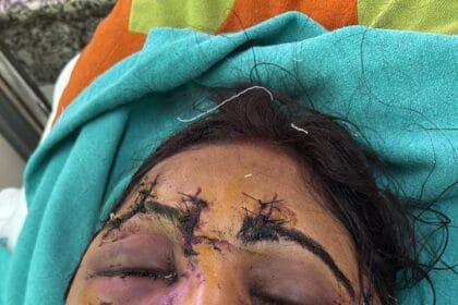 दिल्ली में दहेज उत्पीड़न का क्रूर मामला: दो बहनों पर ससुराल वालों ने किया जानलेवा हमला, अस्पताल में भर्ती