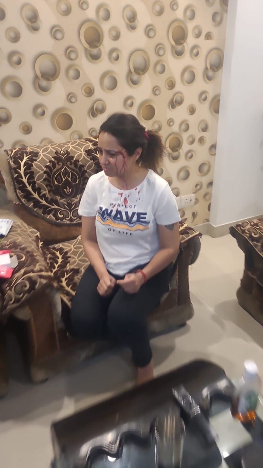 ग्रेटर नोएडा: विधायक की बेटी पर मारपीट का आरोप, टक्कर के बाद सोसाइटी में हंगामा, वीडियो वायरल