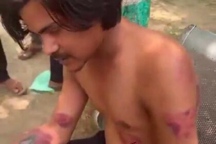 ग्रेटर नोएडा: आबकारी निरीक्षक पर सेल्समैन की बर्बर पिटाई का आरोप, अधिकारी बोले- भागते हुए लगी चोट