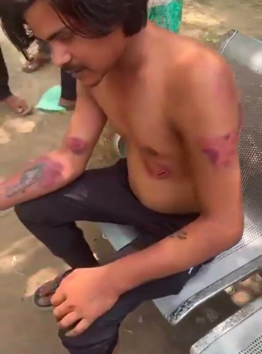 ग्रेटर नोएडा: आबकारी निरीक्षक पर सेल्समैन की बर्बर पिटाई का आरोप, अधिकारी बोले- भागते हुए लगी चोट