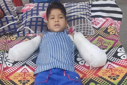 ग्रेटर नोएडा बिजली विभाग की लापरवाही अच्छेजा बुजुर्ग गांव में 7 साल के बच्चे के दोनों हाथ काटने पड़े 