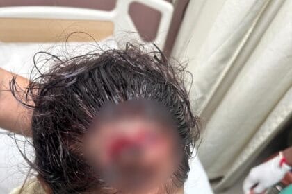 नोएडा: आम्रपाली प्लेटिनम में सुरक्षा की बड़ी चूक, 25वीं मंजिल से गिरी ईंट ने 12 साल की बच्ची का सिर फोड़ा