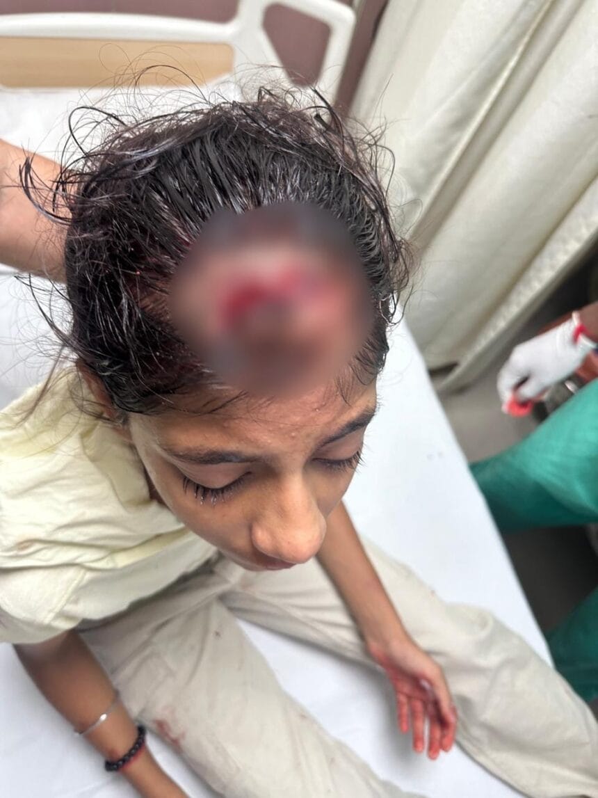 नोएडा: आम्रपाली प्लेटिनम में सुरक्षा की बड़ी चूक, 25वीं मंजिल से गिरी ईंट ने 12 साल की बच्ची का सिर फोड़ा