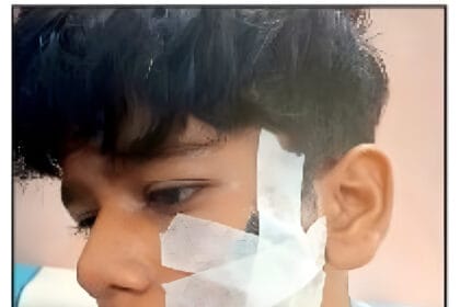 ग्रेटर नोएडा: बैडमिंटन खेलने पर हुए विवाद में छात्र की रैकेट से पिटाई, आरोपी के खिलाफ केस दर्ज