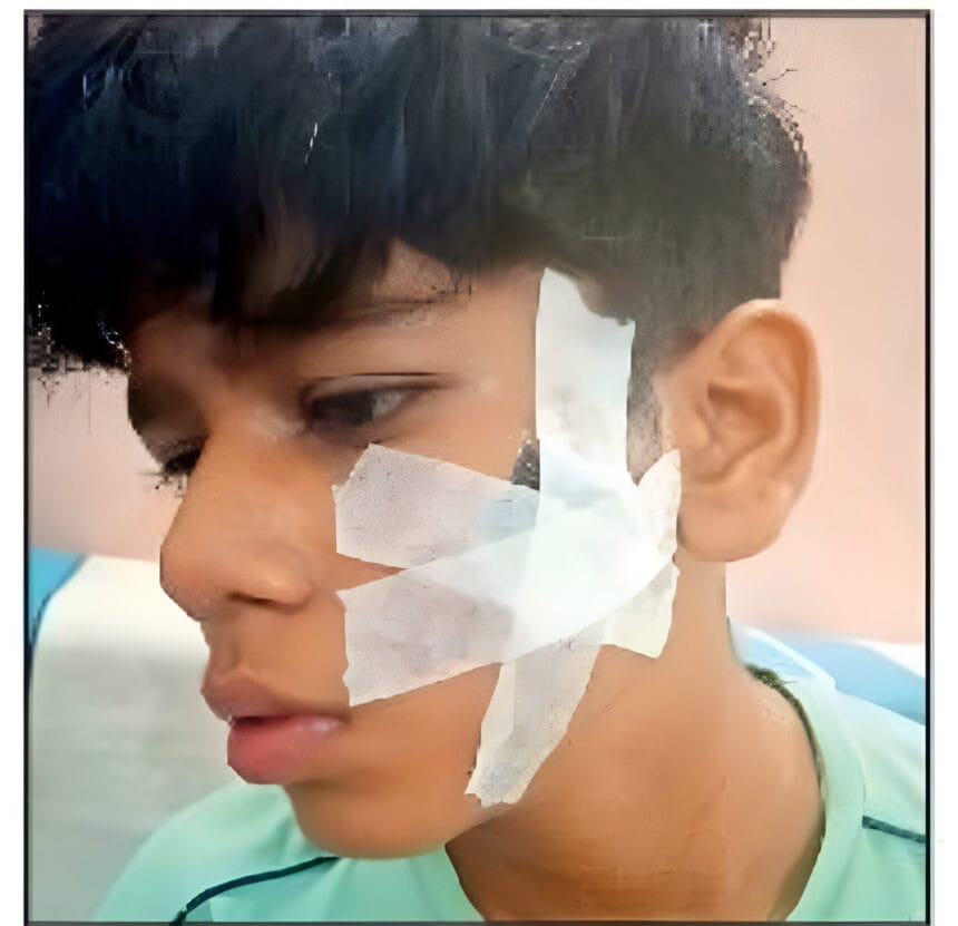 ग्रेटर नोएडा: बैडमिंटन खेलने पर हुए विवाद में छात्र की रैकेट से पिटाई, आरोपी के खिलाफ केस दर्ज